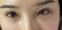 体验后-成都艾特他整形外科医院