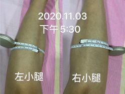 -Lily纤美·科技减脂中心