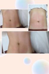-Lily纤美·科技减脂中心