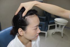 点击看大图 -大麦微针植发丨全国连锁