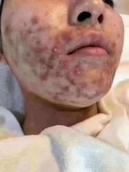 点击看大图 -慕拉美甲美睫皮肤管理