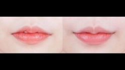 -SKINIST丽铂医疗美容