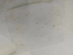 -蕾特恩专业祛痘·皮肤管理