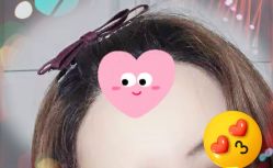 -大麦微针植发全国连锁