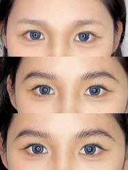 点击看大图 -杨益美学·野生眉半永久纹眉发际线