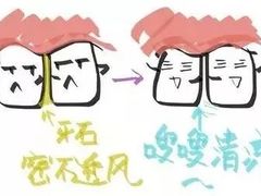 -团圆口腔·种植中心(锦江院区)