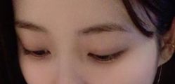 -天津健丽·去眼袋医疗美容机构