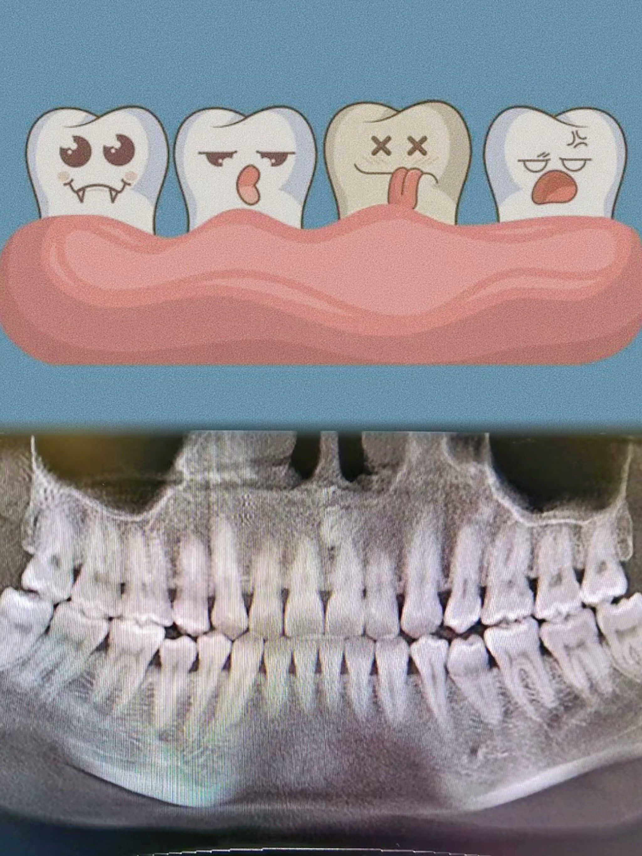 这样的牙齿🦷算口好牙吧❗️