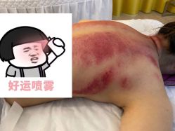 -简悦美塑·徒手点穴减肥