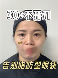 -天津健丽·去眼袋医疗美容机构