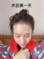 -雍禾植发全国连锁