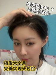 -雍禾植发