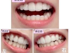 -极光口腔·矫正种植修复(锦江店)