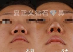 -北京米扬丽格医疗美容·联合丽格鼻整形中心