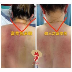 点击看大图 -大唐辣妈东方塑身