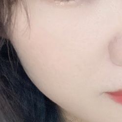 点击看大图 体验后-美瑞莎创美医疗美容