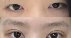 -郡艺医疗美容·微整·眼鼻吸脂