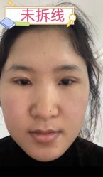 -素美医疗美容·西南眼鼻整形·修复基地