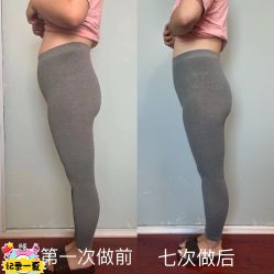 点击看大图 -产后帮产后修复(首城国际店)