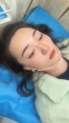 点击看大图 体验后-重庆联合丽格第五医疗美容医院