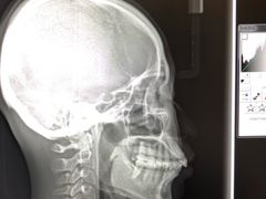 -同步齿科·数字化正畸种植口腔中心(珠海店)