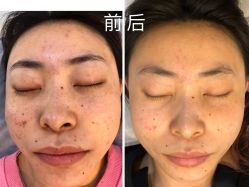 -Cream88颜皮肤管理中心