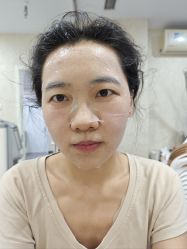 体验后-北京炫美医疗美容