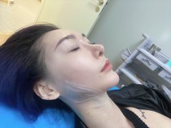 体验后-禾美嘉医疗美容
