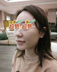 体验前-郡艺医疗美容·微整·眼鼻吸脂