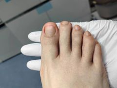 -Andrew指甲专科灰指甲·甲沟炎矫正·3D步态矫形鞋垫定制(上海法华镇路旗舰店)