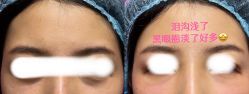 点击看大图 -依萱绮医疗美容
