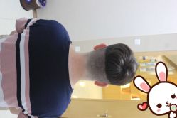 点击看大图 -大麦微针植发丨全国连锁