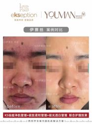 -VE专注问题肌·赛诺龙&科学美肤中心