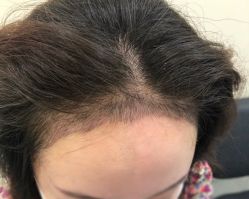 -八大处整形