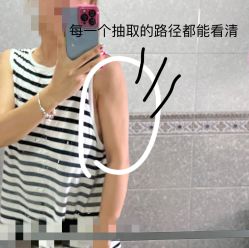 体验后-美莱医疗美容医院