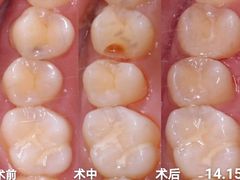 -固瑞齿科·口腔·种植·矫正(恒隆分院)