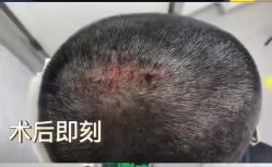 -熙朵美学植发连锁