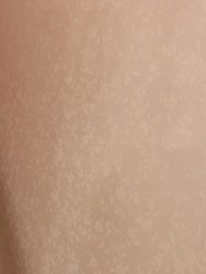 -薇兰专业脱毛连锁机构