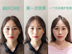 -FACE·日本小颜美容整骨(福田店)