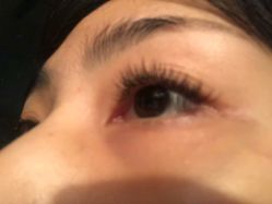 -YOUNGSKIN氧研皮肤管理中心