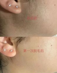 -LUNA皮相美·骨相美高级美感