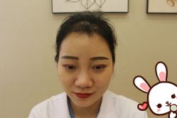 -大麦微针植发丨全国连锁