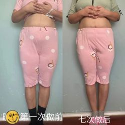 点击看大图 -产后帮产后修复(首城国际店)