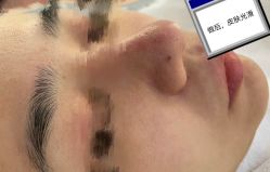 体验后-深圳医恒美医疗美容