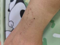 -天道专业洗纹身