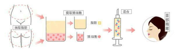 -广东韩妃整形外科医院