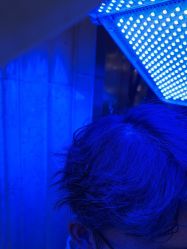 -碧莲盛·不剃发植发