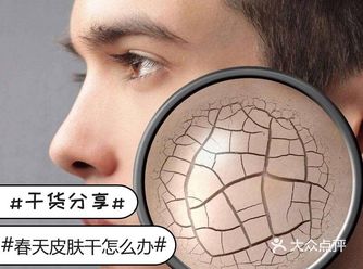 春天皮肤特别干特别缺水怎么办