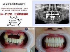 -柏乐口腔医院·舒适化无痛种植牙中心(东盟商务区院)