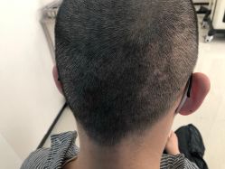 -雍禾植发全国连锁